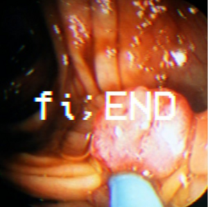 fi;END